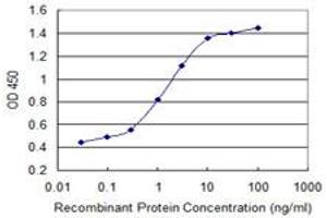 Detection limit for recombinant GST tagged CABP4 is 0. (CABP4 抗体  (AA 1-170))
