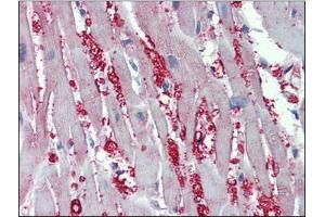 Human Heart: Formalin-Fixed, Paraffin-Embedded (FFPE) (alpha 1 Adrenergic Receptor 抗体  (AA 206-270))