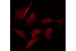 ABIN6275389 staining MCF7 by IF/ICC. (KCNV2 抗体  (N-Term))