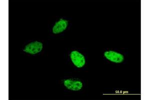 Immunofluorescence of monoclonal antibody to AOF2 on HeLa cell. (LSD1 抗体  (AA 753-851))