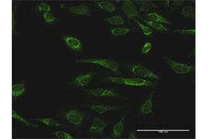 Immunofluorescence (IF) image for anti-Peroxiredoxin 3 (PRDX3) (AA 1-256) antibody (ABIN524344)