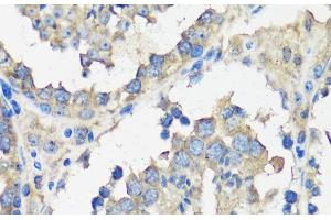 Immunohistochemistry of paraffin-embedded Mouse testis using ASZ1 Polyclonal Antibody at dilution of 1:100 (40x lens). (ASZ1 抗体)
