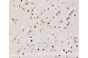 ABIN6266649 at 1/100 staining human brain tissue sections by IHC-P. (UBR5 抗体  (N-Term))