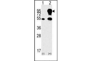 Image no. 1 for anti-B-Raf proto-oncogene, serine/threonine kinase (BRAF) (Middle Region) antibody (ABIN360129) (BRAF 抗体  (Middle Region))