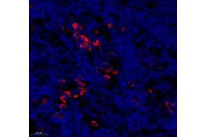 Immunofluorescence (Paraffin-embedded Sections) (IF (p)) image for anti-Membrane-Spanning 4-Domains, Subfamily A, Member 2 (Fc Fragment of IgE, High Affinity I, Receptor For, beta Polypeptide) (MS4A2) antibody (ABIN7074594)