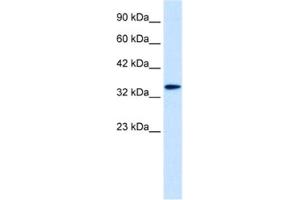 Western Blotting (WB) image for anti-Distal-Less Homeobox 6 (DLX6) antibody (ABIN2461204)