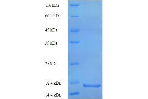 SDS-PAGE (SDS) image for phospholipase A2 Receptor 1, 180kDa (PLA2R1) (AA 395-530) protein (His tag) (ABIN5714346)