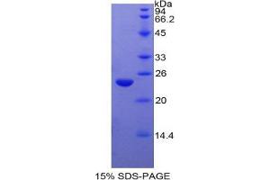 SDS-PAGE analysis of Cow PPARG Protein. (PPARG 蛋白)