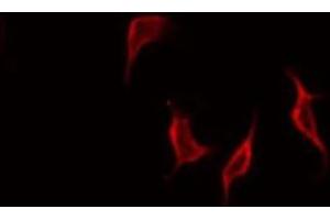 ABIN6268776 staining HepG2 by IF/ICC. (MMP 9 抗体  (C-Term))