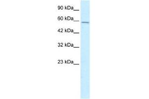 Human HepG2; WB Suggested Anti-MGC4618 Antibody Titration: 0. (TMEM175 抗体  (N-Term))