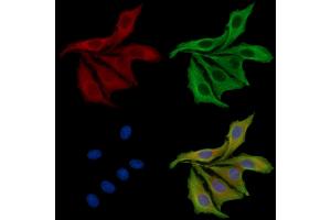 ABIN7095447 and ABIN7099504 staining HepG2 cells by IF/ICC.
