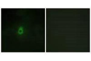 Immunofluorescence (IF) image for anti-Cytochrome P450, Family 2, Subfamily E, Polypeptide 1 (CYP2E1) (C-Term) antibody (ABIN7180154)