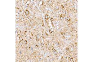 Immunohistochemistry of paraffin-embedded rat brain using NDUFB9 Rabbit mAb (ABIN7268815) at dilution of 1:200 (40x lens). (NDUFB9 抗体)