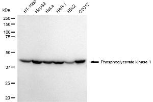 Western blotting analysis using Phosphoglycerate kinase 1 antibody (ABIN7799809). (PGK1 抗体)