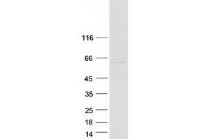 Western Blotting (WB) image for Malate Dehydrogenase 1B, NAD (Soluble) (MDH1B) protein (Myc-DYKDDDDK Tag) (ABIN2725672)