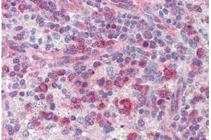 Immunohistochemistry (Formalin-fixed Paraffin-embedded Sections) (IHC (fp)) image for anti-ATP Synthase, H+ Transporting, Mitochondrial F1 Complex, epsilon Subunit (ATP5E) (AA 1-52) antibody (ABIN574212)