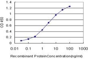 Detection limit for recombinant GST tagged MKI67 is approximately 0. (Ki-67 抗体  (AA 3157-3256))