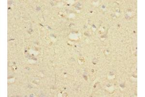 Immunohistochemistry of paraffin-embedded human brain tissue using ABIN7161462 at dilution of 1:100 (Neurotrimin 抗体  (AA 30-316))
