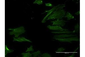Immunofluorescence of monoclonal antibody to DPH2 on HeLa cell. (DPH2 抗体  (AA 1-489))