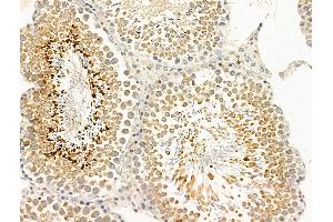 ABIN7094857 and ABIN7098908 at 1/100 staining Rat testis tissue by IHC-P. (CCDC34 抗体  (C-Term))