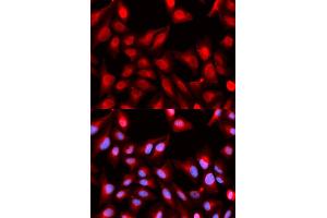 Immunofluorescence analysis of U2OS cells using DDX5 antibody (ABIN5973042). (DDX5 抗体)