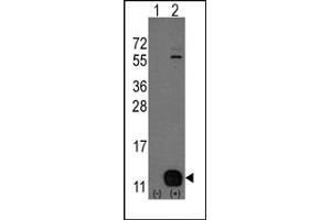 Image no. 1 for anti-phosphohistidine Phosphatase 1 (PHPT1) (N-Term) antibody (ABIN357857) (PHPT1 抗体  (N-Term))