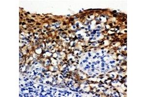 IHC-P: 14-3-3 sigma antibody testing of human tonsil tissue (14-3-3 sigma/SFN 抗体  (AA 140-156))
