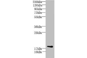 Western Blot All lanes: MORN5 antibody at 4 μg/mL + Mouse brain tissue Secondary Goat polyclonal to rabbit IgG at 1/10000 dilution Predicted band size: 19, 21 kDa Observed band size: 19 kDa (MORN5 抗体  (AA 1-161))