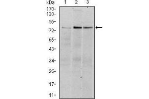 Western Blotting (WB) image for anti-Ribosomal Protein S6 Kinase, 90kDa, Polypeptide 3 (RPS6KA3) antibody (ABIN969386)