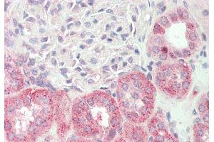Rabbit Anti-KLHL25 antibody  Formalin Fixed Paraffin Embedded Tissue: Human Kidney Primary antibody Concentration: 1:100 Secondary Antibody: Donkey anti-Rabbit-Cy3 Secondary Antibody Concentration: 1:200 Magnification: 20x Exposure Time: 0. (KLHL25 抗体  (N-Term))