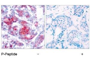 Image no. 1 for anti-Signal Transducer and Activator of Transcription 4 (STAT4) (pTyr693) antibody (ABIN196694) (STAT4 抗体  (pTyr693))