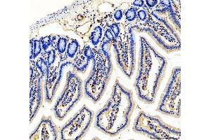 IHC analysis of CD31 using anti-CD31 antibody (ABIN5692990).