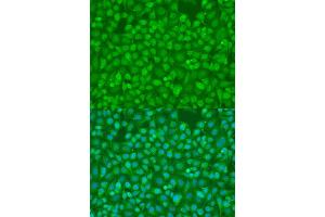 Immunofluorescence analysis of U2OS cells using SMAD7 antibody (ABIN2737563) at dilution of 1:100. (SMAD7 抗体)