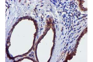 Immunohistochemical staining of paraffin-embedded Human breast tissue using anti-EPN2 mouse monoclonal antibody. (Epsin 2 抗体)