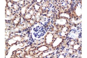 Formalin-fixed and paraffin embedded mouse kidney labeled with Anti-MCP1/CCL2 Polyclonal Antibody, Unconjugated (ABIN737676) at 1:200 followed by conjugation to the secondary antibody and DAB staining. (CCL2 抗体  (AA 61-148))