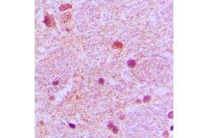 Immunohistochemical analysis of TP53INP1 staining in human brain formalin fixed paraffin embedded tissue section. (TP53INP1 抗体  (C-Term))
