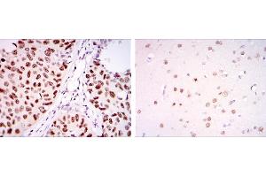 Immunohistochemistry (IHC) image for anti-PC4 and SFRS1 Interacting Protein 1 (PSIP1) antibody (ABIN969370)