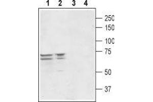 Western blot analysis of rat (lanes 1 and 3) and mouse (lanes 2 and 4) brain lysates: - 1,2. (Peroxisomal Biogenesis Factor 5-Like (PEX5L) (AA 151-165), (Intracellular) 抗体)