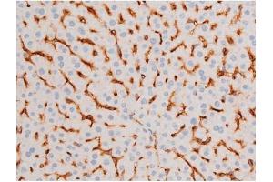 Immunohistochemistry (IHC) image for anti-Forkhead Box O4 (FOXO4) (pSer197) antibody (ABIN6255069)