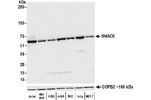 Western Blotting (WB) image for anti-SMAD, Mothers Against DPP Homolog 2 (SMAD2) (AA 225-275) antibody (ABIN7454016)