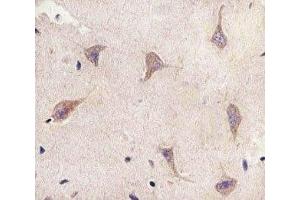 IHC analysis of FFPE human brain section using TSC2 antibody; Ab was diluted at 1:25. (Tuberin 抗体  (AA 1397-1426))