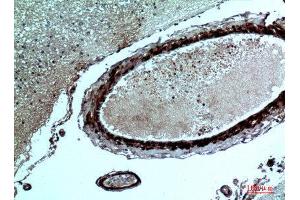 Immunohistochemistry (IHC) analysis of paraffin-embedded Human Brain, antibody was diluted at 1:100. (FGF17 抗体  (Internal Region))