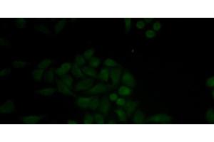 Immunofluorescence analysis of MCF-7 cells using CTSE Polyclonal Antibody (Cathepsin E 抗体)