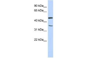 FAM81B antibody used at 1 ug/ml to detect target protein. (FAM81B 抗体  (N-Term))