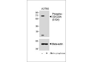 Western blot analysis of lysates from  cell line, untreated or treated with Alkaline phosphatase, 1h, using 459088101 A (upper) or Beta-actin (lower). (CDC25A 抗体  (pSer124))