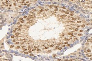 Immunohistochemistry analysis of paraffin-embedded mouse testis using,TEX11 (ABIN7075862) at dilution of 1: 2000 (TEX11 抗体)
