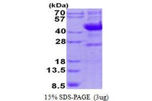 Image no. 1 for Sialidase 1 (Lysosomal Sialidase) (NEU1) protein (His tag) (ABIN1098375) (NEU1 Protein (His tag))
