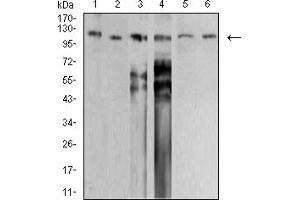 Western blot analysis using SMARCA1 mouse mAb against PANC-1 (1), HEK293 (2), SW620 (3), HT-29 (4), SH-SY5Y (5), and SK-OV-3 (6) cell lysate. (SMARCA1 抗体  (AA 933-1070))