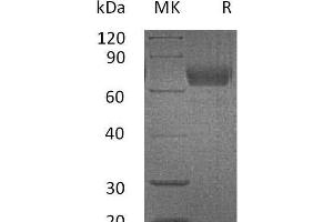 Western Blotting (WB) image for Interleukin 4 Receptor (IL4R) protein (Fc Tag) (ABIN7320861)
