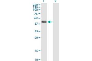 Western Blot analysis of NDRG2 expression in transfected 293T cell line by NDRG2 monoclonal antibody (M03), clone 6A5. (NDRG2 抗体  (AA 1-96))